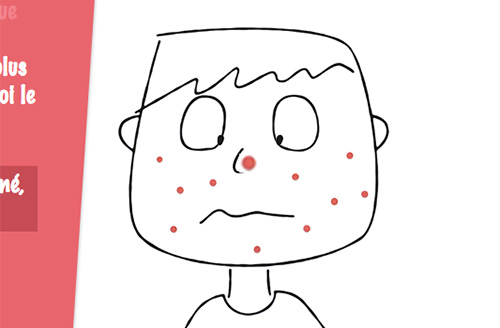 Exemple projet Tout sur l'acné